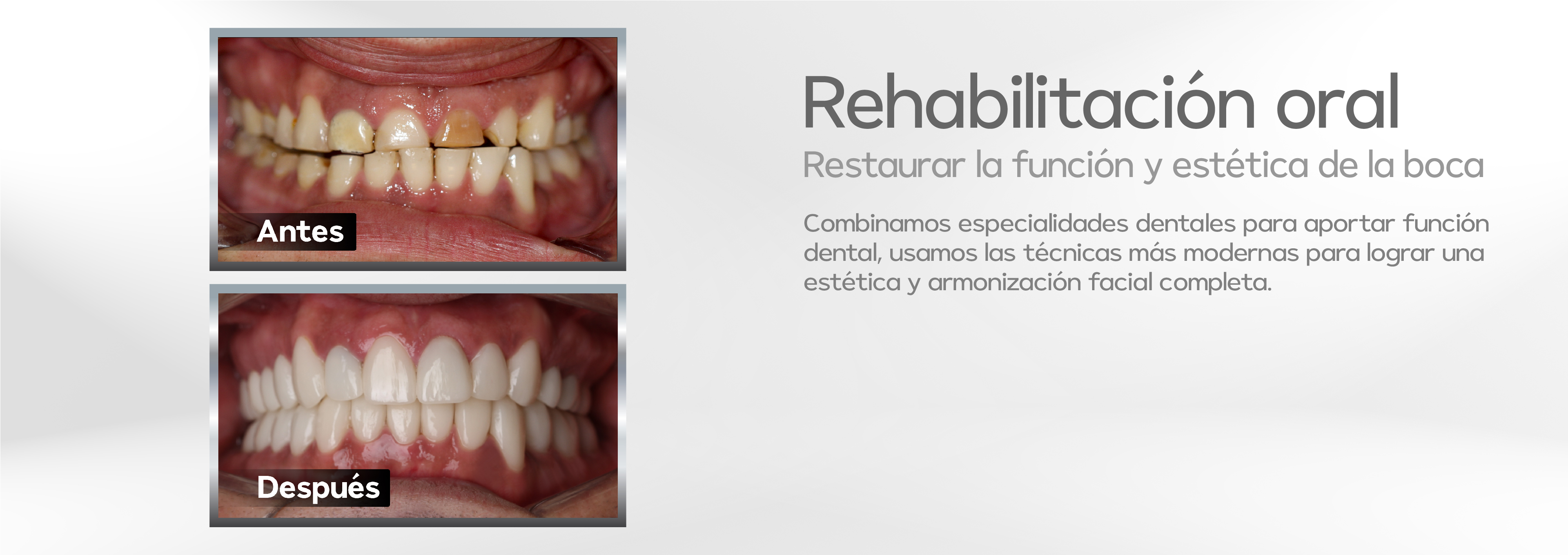 rehabilitación oral tello odontología cochabamba bolivia